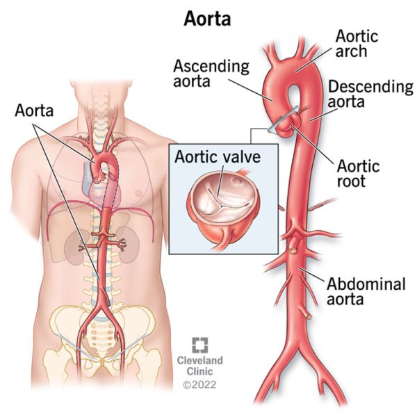 17058-aorta-anatomy